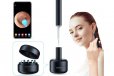 Bebird X17 Pro Smart Visual Ear Cleaning Kit